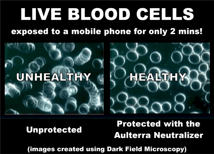 Live blood cells showing damage caused by EMFs and healthy protected cells when using Aulterra EMF Neutralizer products