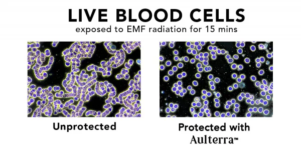 Live blood cells showing damage caused by EMFs and healthy protected cells when using Aulterra EMF Neutralizer products