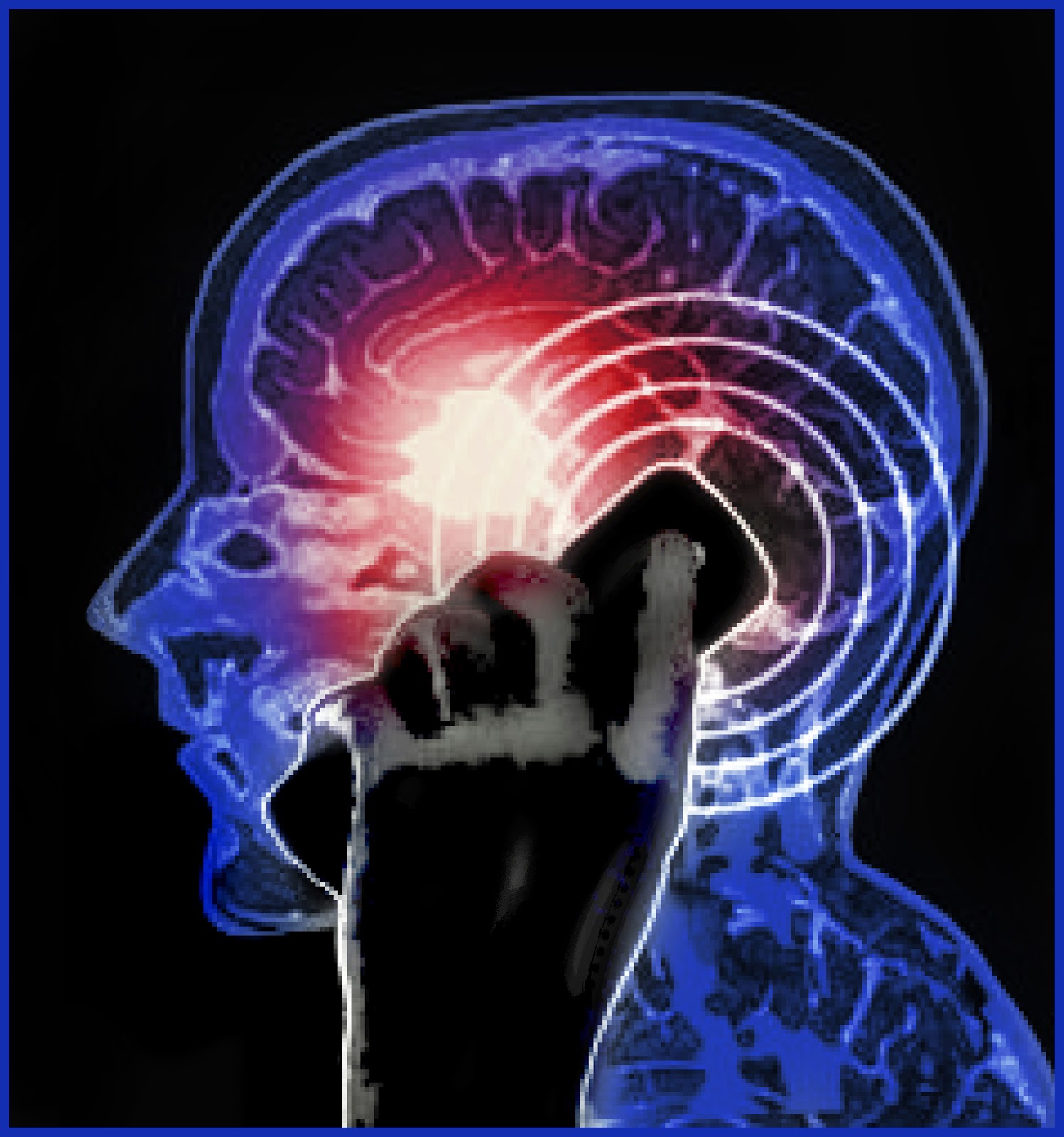 Illustration of phone EMFs penetrating the brain