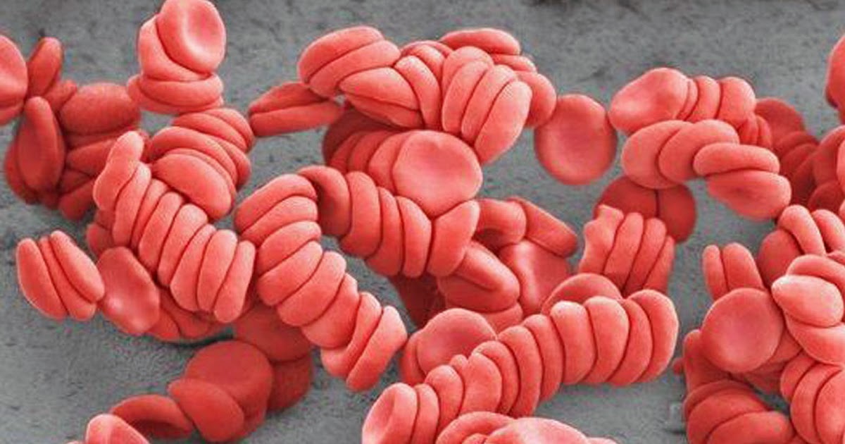 EMF exposure causes blood cell Rouleaux formation